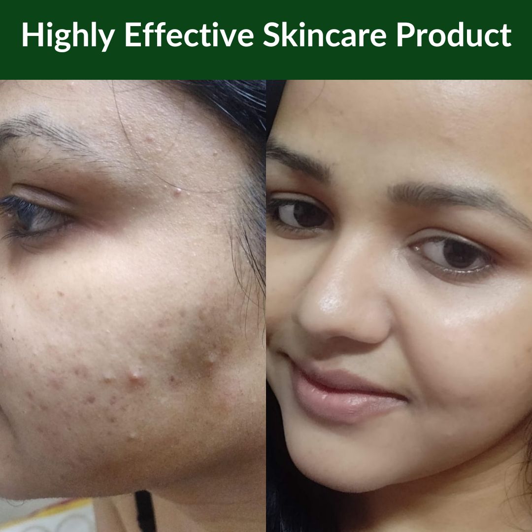 Night Repair Elixir (Glow) Night Repair Elixir (Glow)